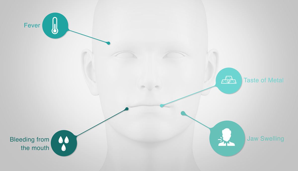 emergency dental symptoms